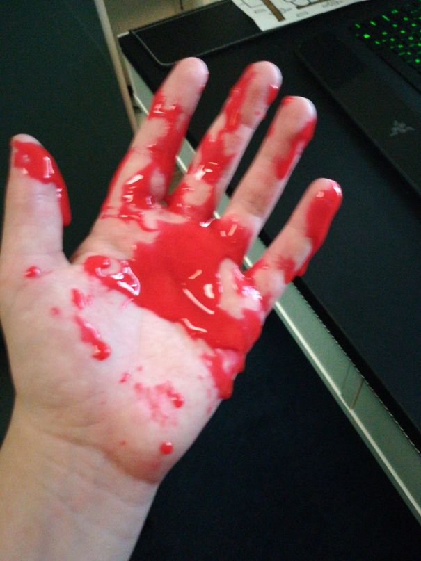 My Stress Ball Just Exploded