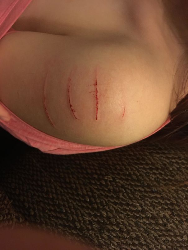 Was Playing Fetch With My Kitten When She Used My Shoulder As A Launch Pad