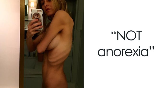 90 Brutally Honest Photos Of Post-Baby Bodies, That Women Are Sharing To Reveal The Truth No One Talks About