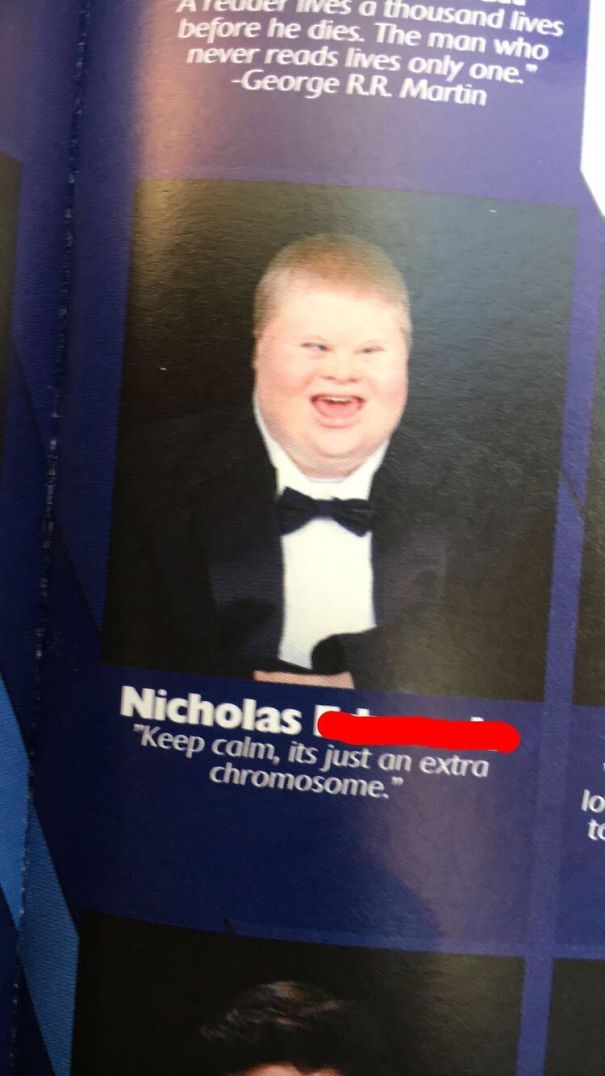 Bleib ruhig, es ist nur ein extra Chromosom