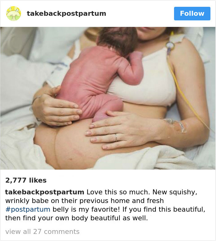 Postpartum Bodies