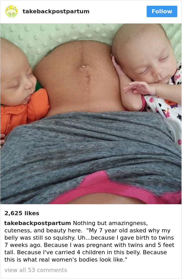 Postpartum Bodies