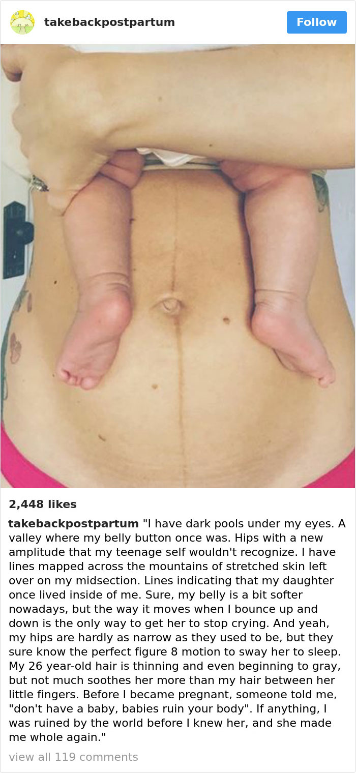 Postpartum Bodies