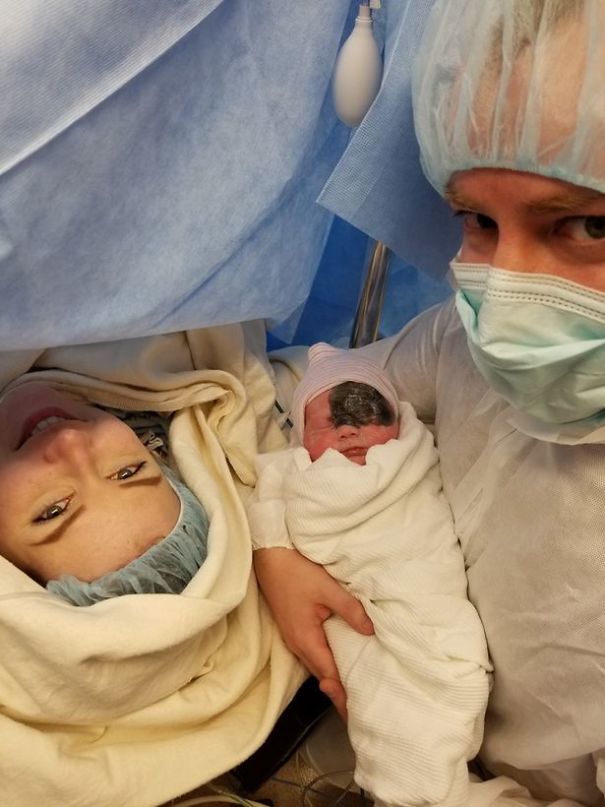 This Baby Was Born With A Birthmark Which Turned Her Into "Little Superhero"