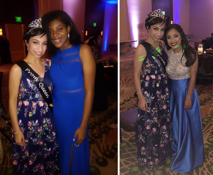 Teen Shocks Her Prom Date By Walking For The First Time In 10 Months, And His Reaction Says It All