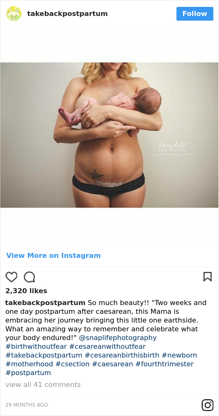 Postpartum Bodies
