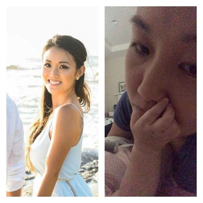 Before And After Having Children