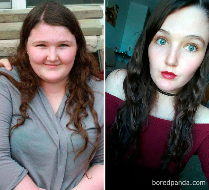 Lost 91 Lbs In 2 Years. Face Progress!