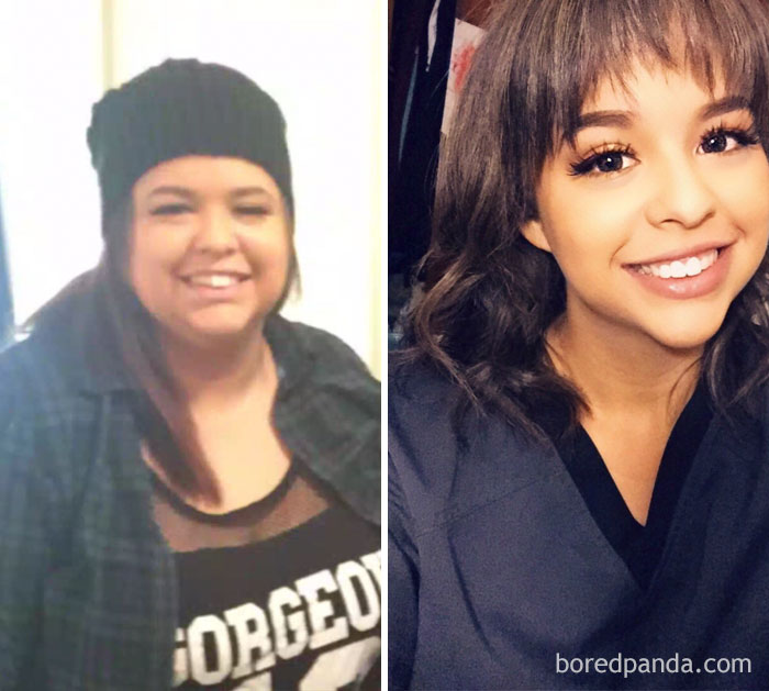 Lost 100 Lbs. Face Before And After