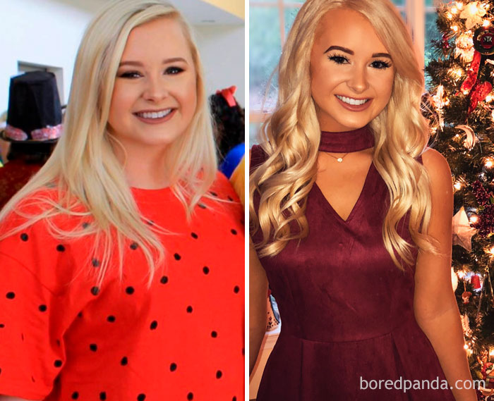 40 Lbs Lost In 6 Months. This Is Called "The Return Of The Jawline"