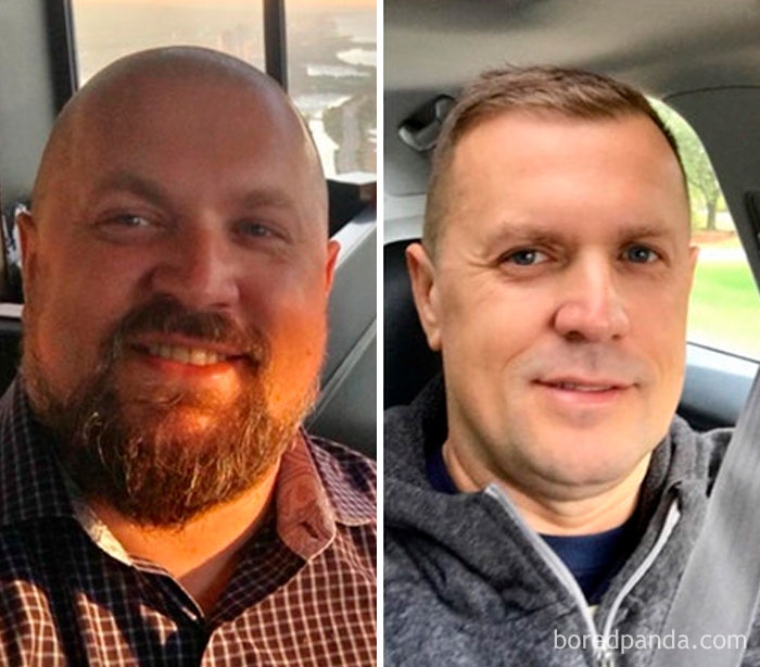 I’ve Lost 86 Lb In 9 Months. Haven’t Seen Myself Like That In 15 Years