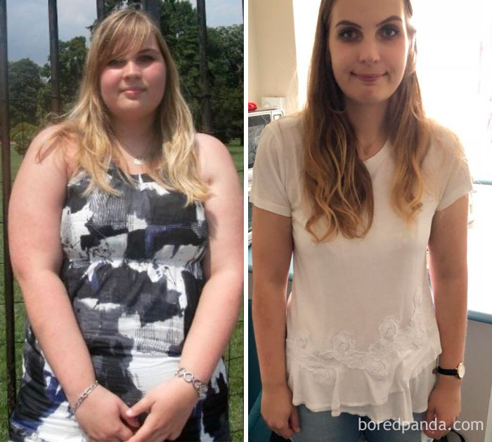 I Just Want To Share This Inspiring Photo Of My Girlfriend Who Has Been Overweight Her Entire Life Until She Finally Decided To Make A Change. She Lost 45 Kg