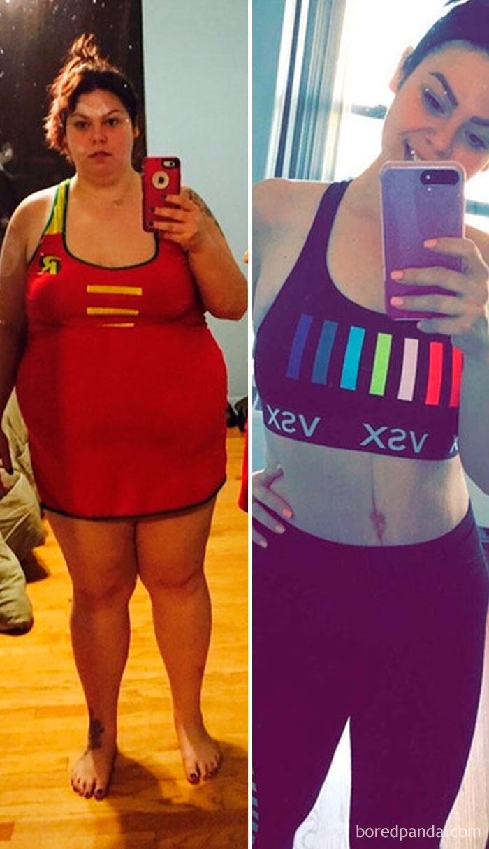 GF Transformation Picture. She Lost 160ish Pounds Over 1 Year And Had Surgery 4 Weeks Ago To Remove The Excess Skin