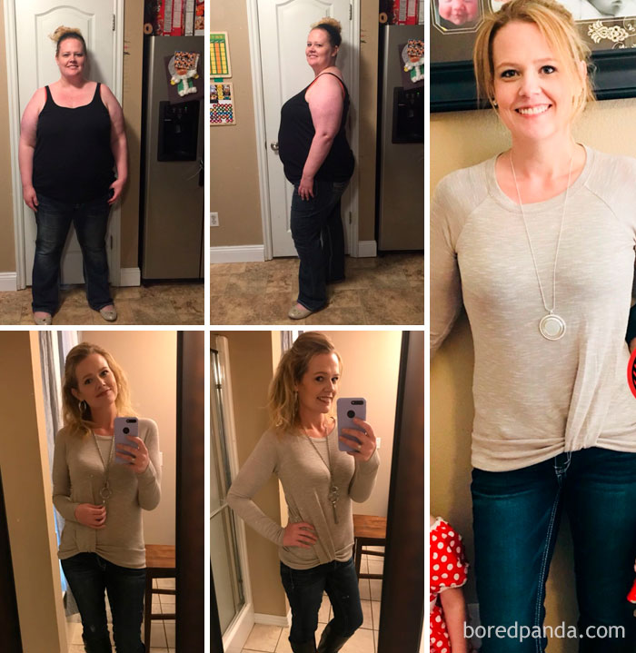 From 315 Lbs To 150 Lbs. Healthier, In Remission From Pseudotumor Cerebri/IIH And No Longer Going Blind