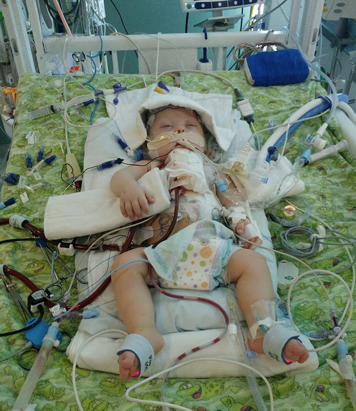 Toddler With Down Syndrome Says His First Word After His Sister Sings Him A Song, And It Will Melt Your Heart Toddler With Down Syndrome Says His First Word After His Sister Sings Him A Song, And It Will Melt Your Heart