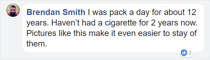 Shocking Video Of Nurse Inflating Healthy Lungs Vs Smoker's Reveals What Cigarettes Really Do To You