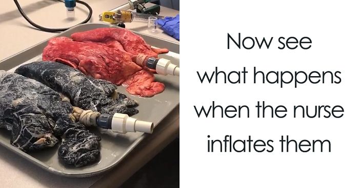 Shocking Video Of Nurse Inflating Healthy Lungs Vs Smoker’s Reveals What Cigarettes Really Do To You