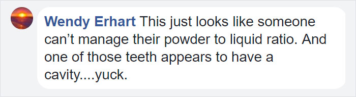 Teeth-Nails Exist, And If You Think They Can't Get Any Worse, Watch This Video