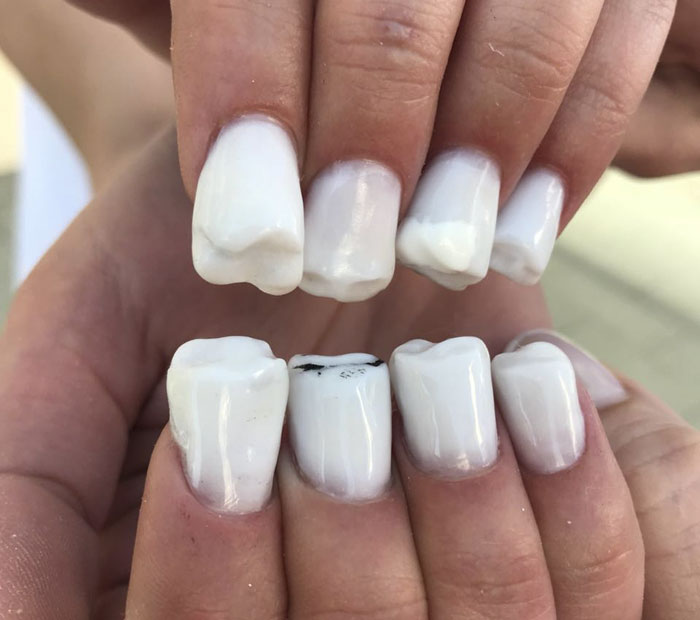 Teeth-Nails Exist, And If You Think They Can't Get Any Worse, Watch This Video Teeth-Nails Exist, And If You Think They Can't Get Any Worse, Watch This Video