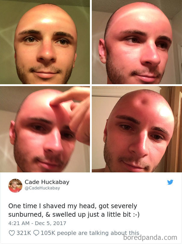 He Looks Like Doughnut