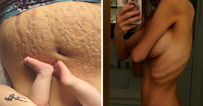 10+ Fotos brutalmente honestas de cuerpos post-parto que las mujeres comparten para mostrar la verdad de la que nadie habla
