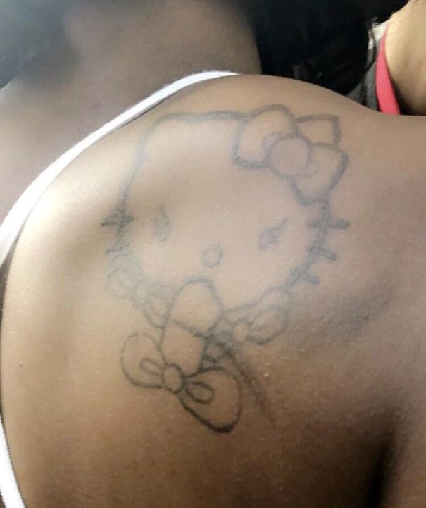 Poorly drawn tattoo of a cartoon cat on a person's shoulder, showcasing a humorous and cringe-worthy tattoo fail.