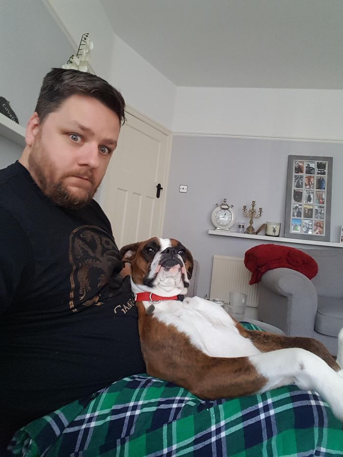 Man with a surprised expression sits on a couch with an adorable boxer dog lying comfortably on his lap.