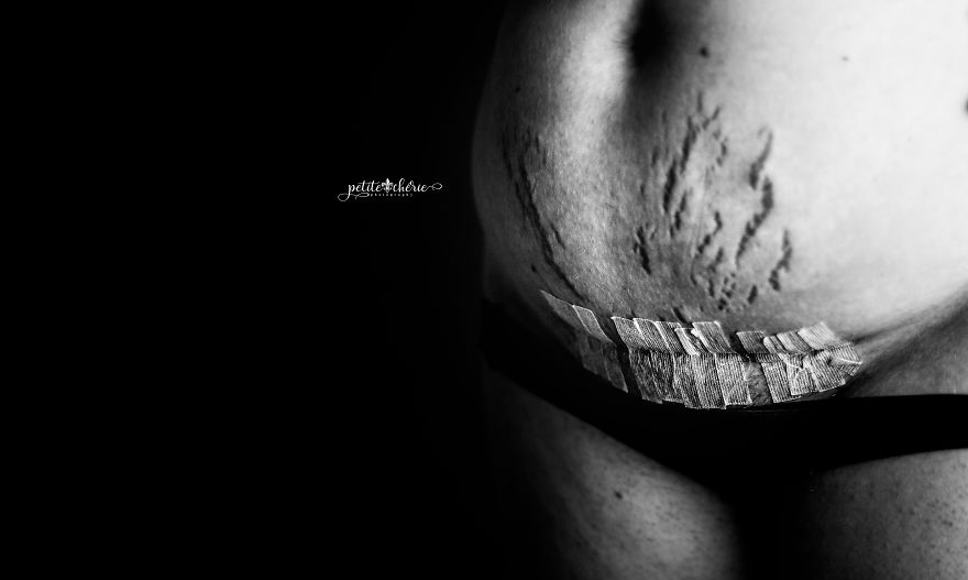 Celebrating The Postpartum Body