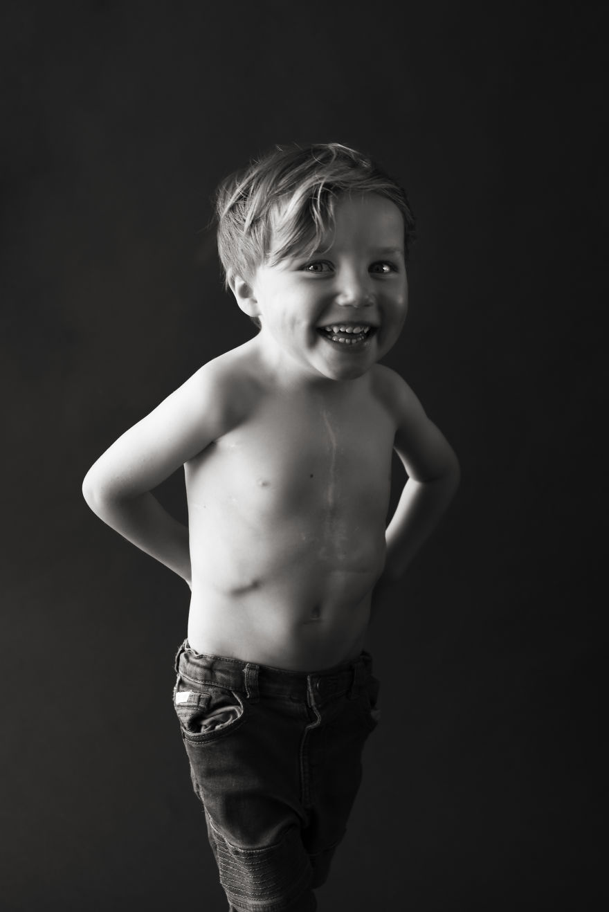 Scar Portraits Scar Portraits