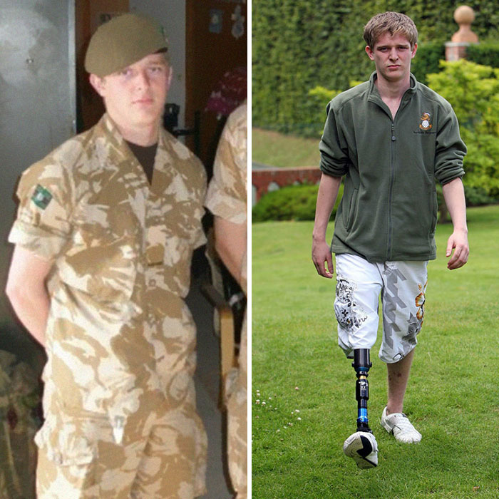 amputee-soldier-anti-racist-message-chris-herbert-24