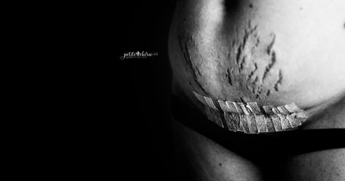 Celebrating The Postpartum Body