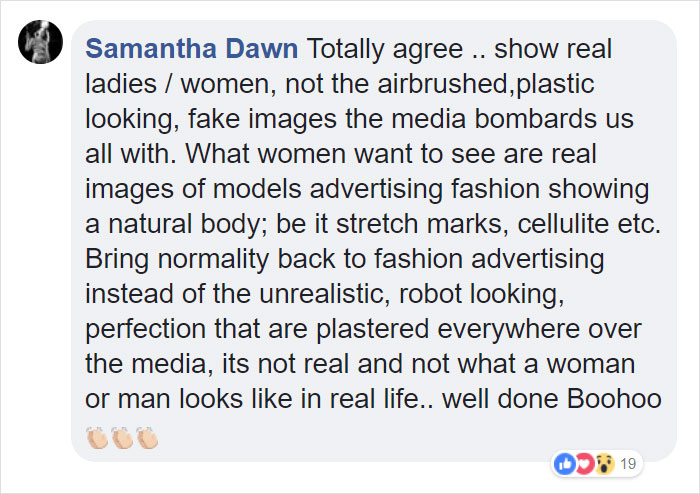 Boohoo Posts Image Without Photoshopping Model's "Imperfections" Out And The Internet Is Saying FINALLY