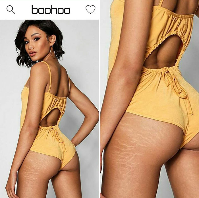 Boohoo Posts Image Without Photoshopping Model's "Imperfections" Out And The Internet Is Saying FINALLY Boohoo Posts Image Without Photoshopping Model's "Imperfections" Out And The Internet Is Saying FINALLY