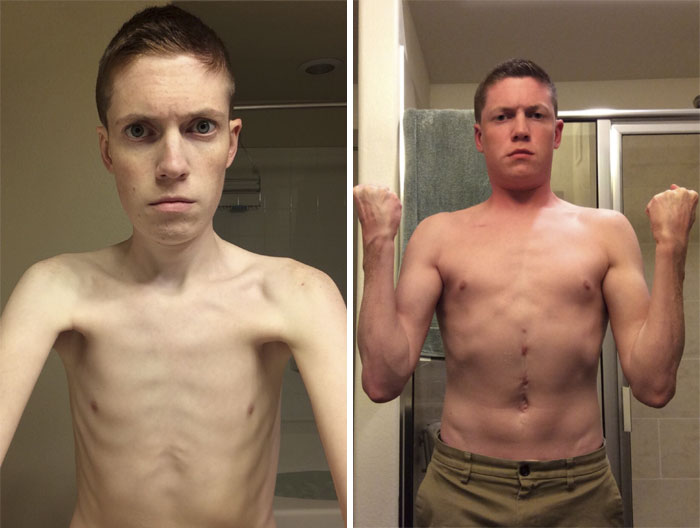 I’ve Gained 40 Lbs In 8 Months