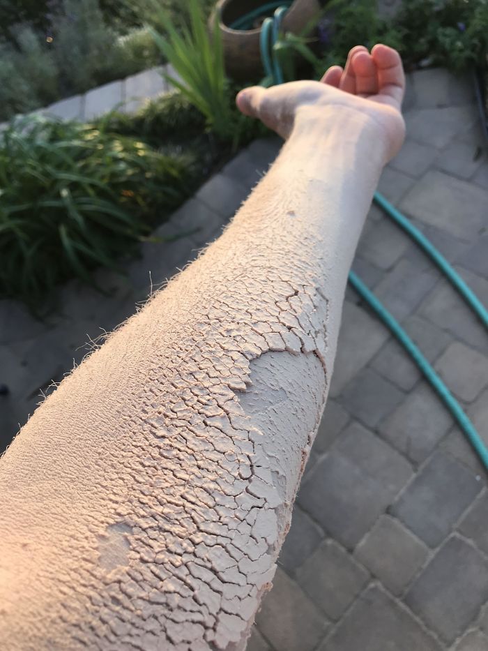 This Wood Dust Makes My Arm Look Like Dry, Cracked Dirt