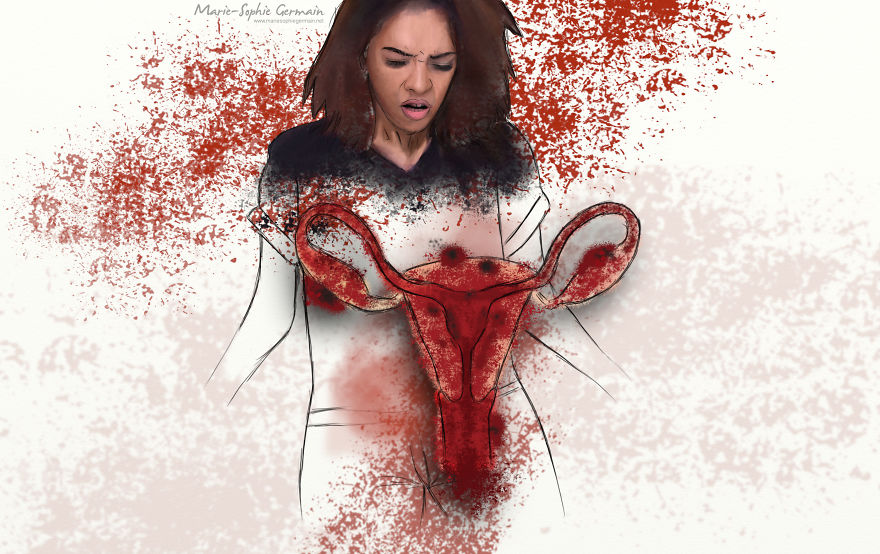 I Make Rough Drawings To Show The Reality Of Endometriosis I Make Rough Drawings To Show The Reality Of Endometriosis