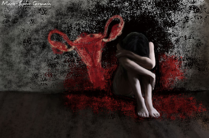 I Make Rough Drawings To Show The Reality Of Endometriosis