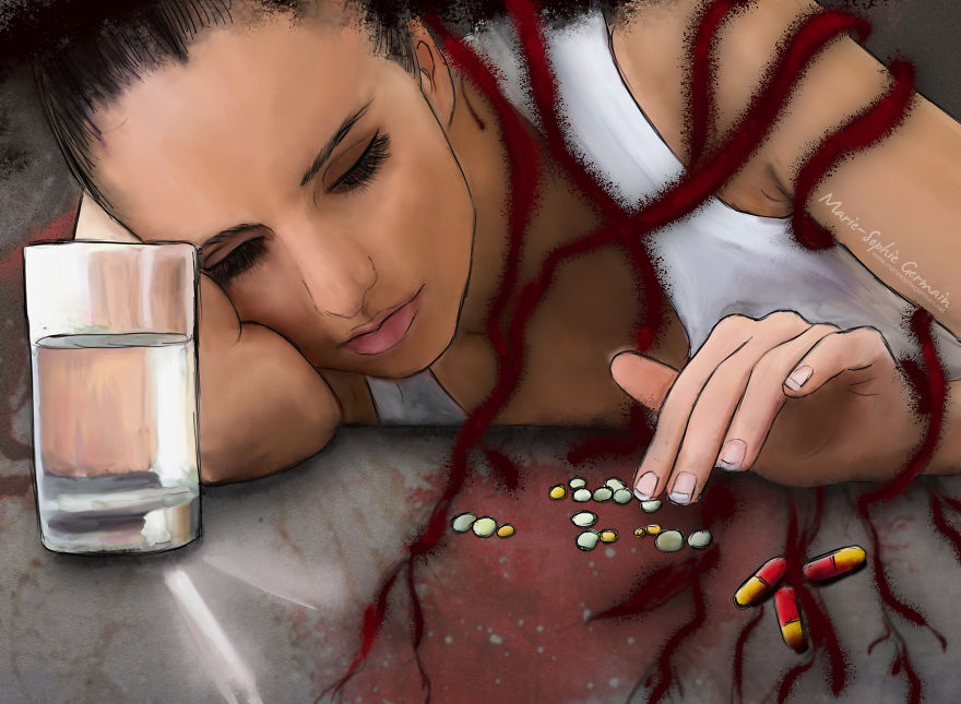 I Make Rough Drawings To Show The Reality Of Endometriosis I Make Rough Drawings To Show The Reality Of Endometriosis