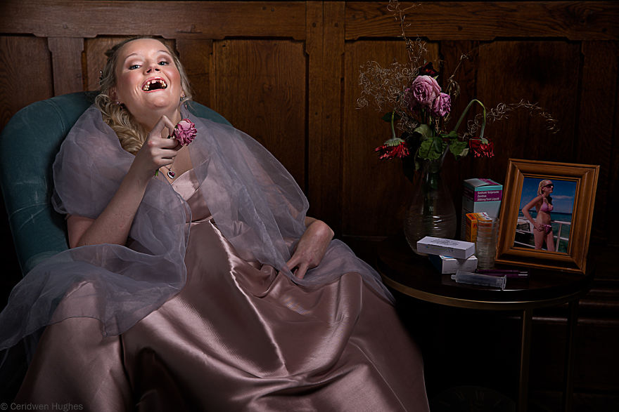 Lizzie Was Diagnosed With Huntington's Disease At 16 And Is Now 26 And Living In A Care Home