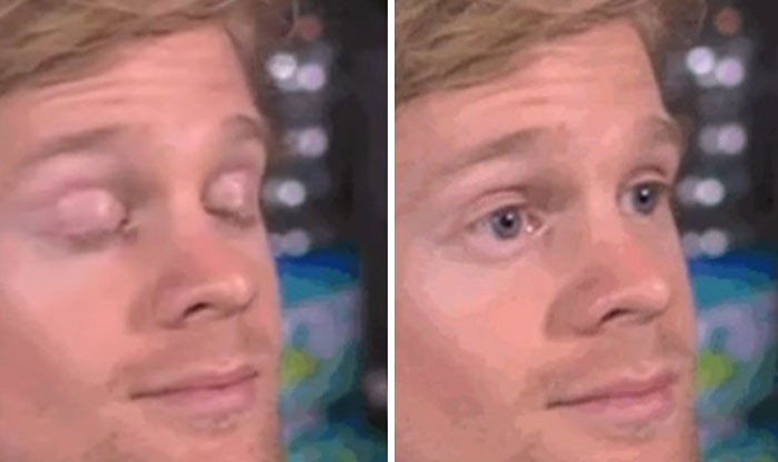 blinking-white-guy-meme blinking-white-guy-meme
