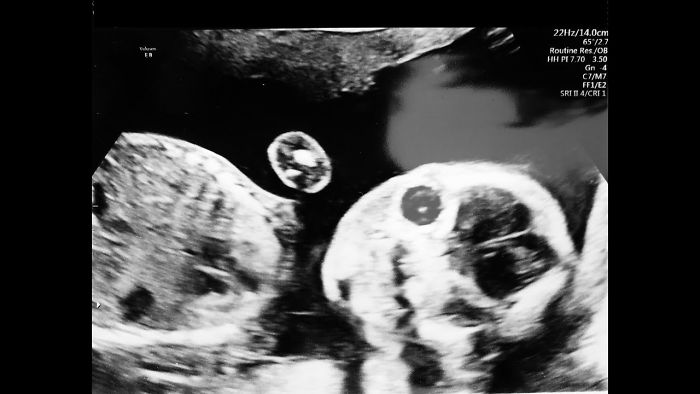 We Recorded Everyone’s Reactions To Our Pregnancy