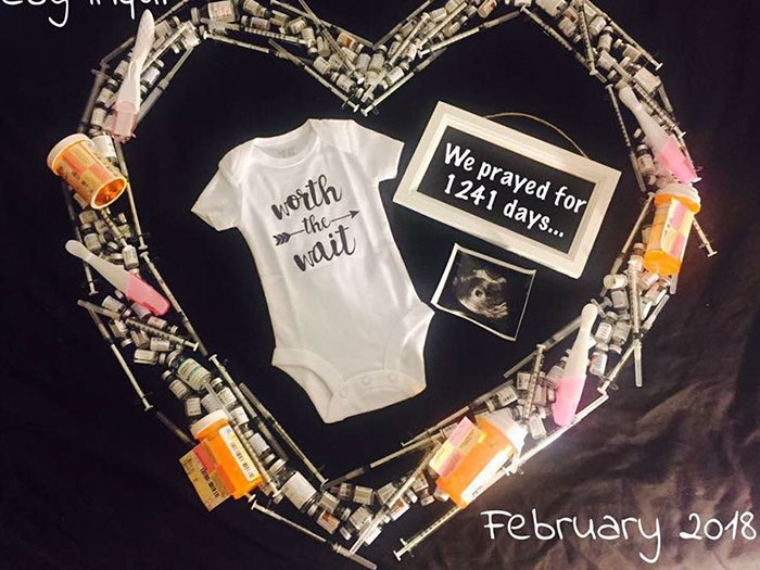 Viral Photo Shows Newborn Baby Surrounded By The 1616 Injection Needles It Took To Make It