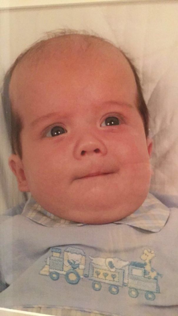 I Was A Balding Baby