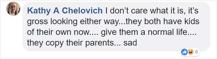 Celebrities Are Getting Temporary Skin "Implants" And It's Freaking People Out