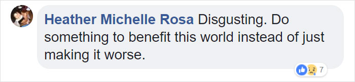 Celebrities Are Getting Temporary Skin "Implants" And It's Freaking People Out Celebrities Are Getting Temporary Skin "Implants" And It's Freaking People Out