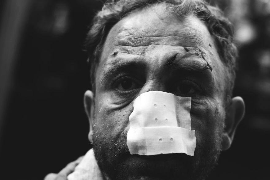 First Pictures That I Made In My Life Show People In Extreme Poverty I Witnessed In My Hometown