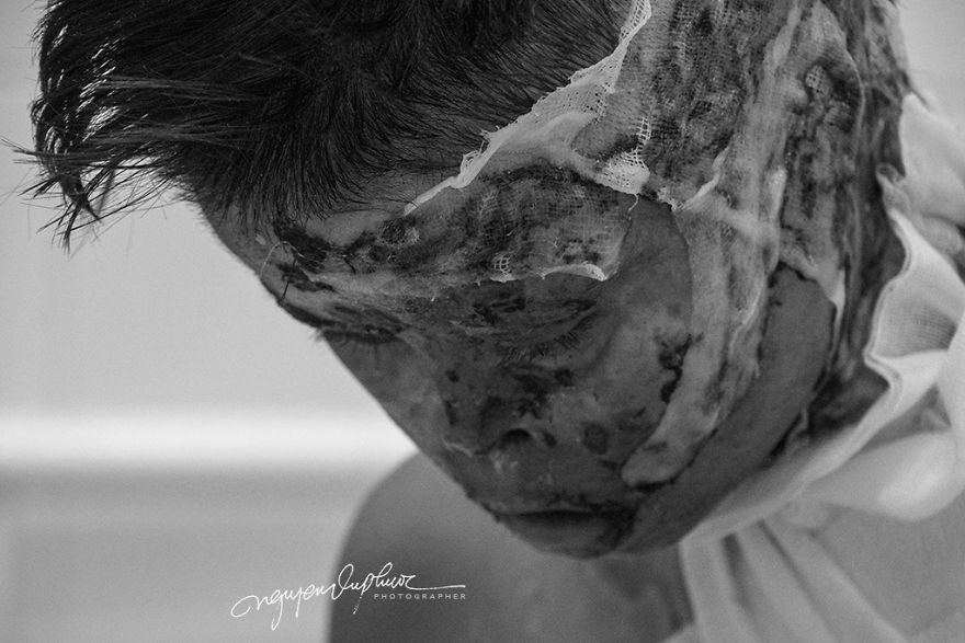 Can Tho City In Vietnam Opened The Trial Court Because Of The Intentionally Caused Injury With Acid Can Tho City In Vietnam Opened The Trial Court Because Of The Intentionally Caused Injury With Acid