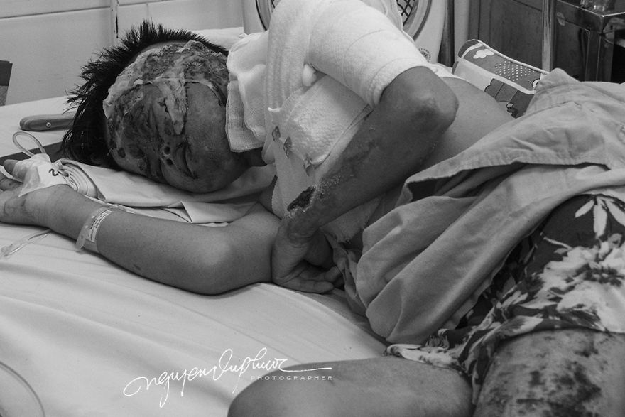 Can Tho City In Vietnam Opened The Trial Court Because Of The Intentionally Caused Injury With Acid