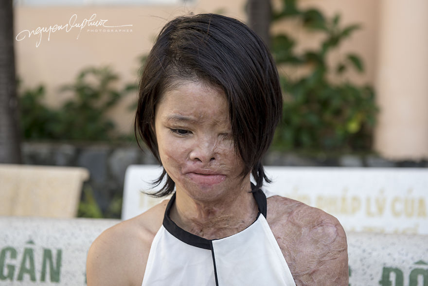 Can Tho City In Vietnam Opened The Trial Court Because Of The Intentionally Caused Injury With Acid Can Tho City In Vietnam Opened The Trial Court Because Of The Intentionally Caused Injury With Acid