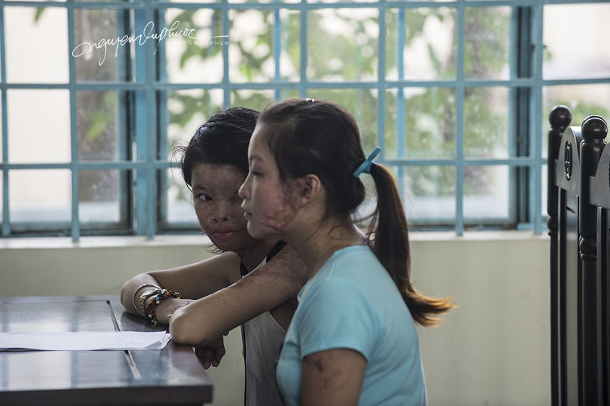 Can Tho City In Vietnam Opened The Trial Court Because Of The Intentionally Caused Injury With Acid